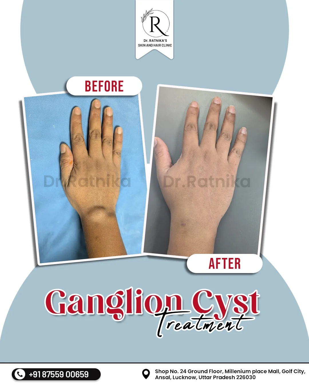 The Basic Rules of Skin Care & Acne Treatment