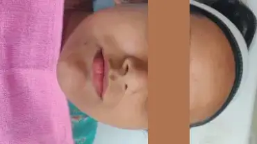  Nail Related Issue