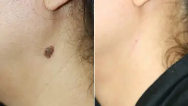  Nail Related Issue