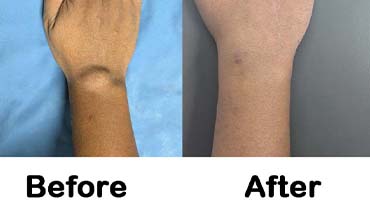 Best Hair Treatment In Lucknow